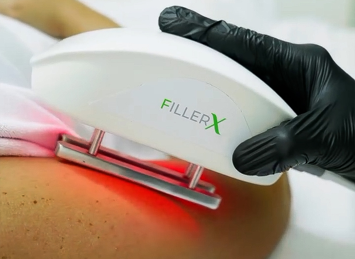 Glowing skin after rejuvenation treatment